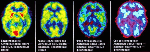 11111Pn4.jpg.4d28ddd67368f227ad0fa47c3f69cb3d.jpg