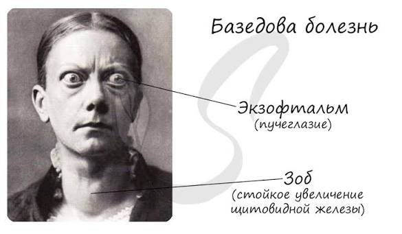 image.png.6130982ee4a14bcf86e796895db6c722.png